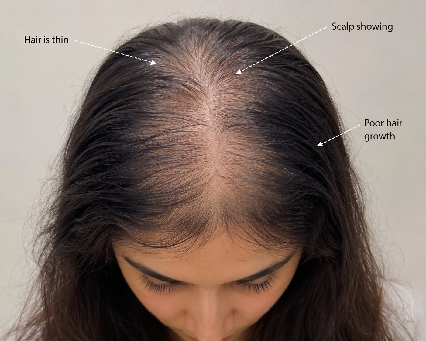 After hair growth